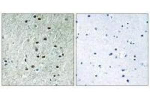 Immunohistochemistry analysis of paraffin-embedded human brain tissue using REXO1 antibody. (REXO1 Antikörper)