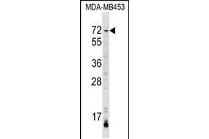 Western blot analysis in MDA-MB453 cell line lysates (35ug/lane). (AMIGO3 Antikörper  (AA 242-268))