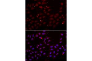 Immunofluorescence analysis of HeLa cells using CST2 antibody (ABIN5973947). (CST2 Antikörper)