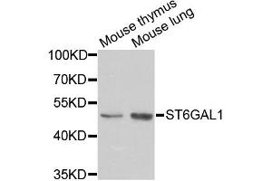 Western blot analysis of extracts of various cell lines, using ST6GAL1 antibody (ABIN5973377) at 1/1000 dilution. (ST6GAL1 Antikörper)
