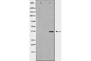 Western blot analysis of Jurkat whole cell lysates, using ACP5 Antibody. (ACP5 Antikörper  (N-Term))