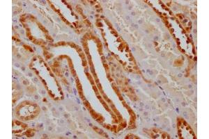 IHC image of ABIN7127532 diluted at 1:100 and staining in paraffin-embedded human kidney tissue performed on a Leica BondTM system.