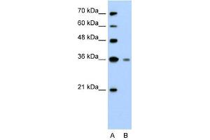 Granzyme H antibody used at 2. (GZMH Antikörper)