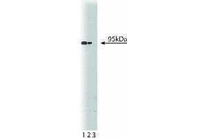 Western blot analysis of CD220 on a mouse liver lysate. (Insulin Receptor Antikörper  (AA 1006-1144))