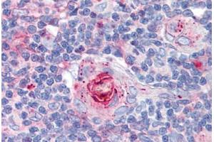Human Thymus (formalin-fixed, paraffin-embedded) stained with ICAM1 antibody ABIN298517 at 10 ug/ml followed by biotinylated anti-mouse IgG secondary antibody ABIN481714, alkaline phosphatase-streptavidin and chromogen. (ICAM1 Antikörper)