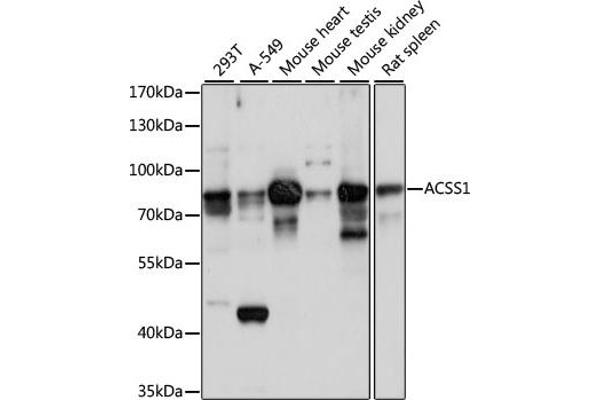 ACSS1 anticorps  (AA 340-689)