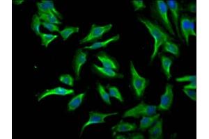 Immunofluorescence staining of Hela Cells with ABIN7127560 at 1:50, counter-stained with DAPI. (Rekombinanter ID1 Antikörper)