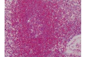 Anti-Tropomyosin 1 antibody IHC of human spleen. (TM7 Antikörper)