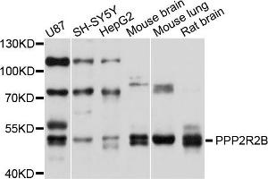 Western blot analysis of extracts of various cells, using PPP2R2B antibody. (PPP2R2B Antikörper)