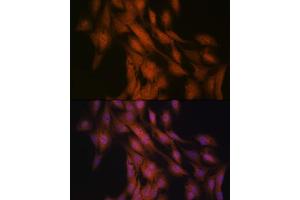 Immunofluorescence analysis of C6 cells using Gli3 Rabbit mAb (ABIN7267385) at dilution of 1:100 (40x lens). (GLI3 Antikörper)