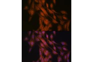 Immunofluorescence analysis of C6 cells using Gli3 Rabbit mAb (ABIN7267385) at dilution of 1:100 (40x lens). (GLI3 Antikörper)