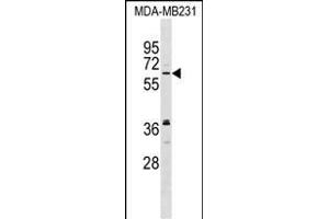NELF Antibody (C-term) (ABIN1537414 and ABIN2848924) western blot analysis in MDA-M cell line lysates (35 μg/lane). (NMDA Receptor Synaptonuclear Signaling and Neuronal Migration Factor (NSMF) (AA 501-530), (C-Term) Antikörper)