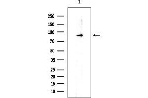 Western blot analysis of lysates from EC304 cells, using DDX21 Mouse Monoclonal Antibody at 1/1000 dilution.