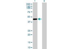 Western Blot analysis of CTSE expression in transfected 293T cell line by CTSE MaxPab polyclonal antibody. (Cathepsin E Antikörper  (AA 18-396))