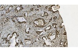 IHC analysis of U2AF65/U2AF2 using anti U2AF65/U2AF2 antibody (ABIN7600795).