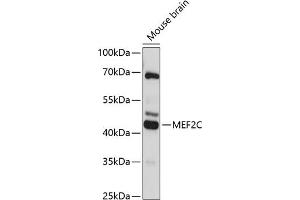 Western blot analysis of extracts of mouse brain, using MEF2C antibody (ABIN6132345, ABIN6143716, ABIN6143717 and ABIN6215998) at 1:3000 dilution. (MEF2C Antikörper  (AA 170-380))