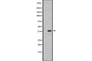 Western blot analysis of OR7E24 expression in 721_B whole cell lysate ,The lane on the left is treated with the antigen-specific peptide. (OR7E24 Antikörper)