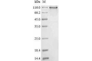 (Tris-Glycine gel) Discontinuous SDS-PAGE (reduced) with 5 % enrichment gel and 15 % separation gel.