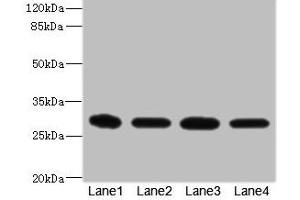 Western blot All lanes: EIF3K antibody at 1. (EIF3K Antikörper  (AA 1-218))