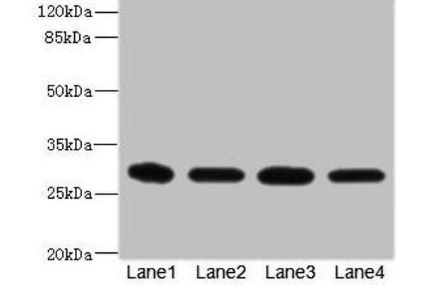EIF3K Antikörper  (AA 1-218)