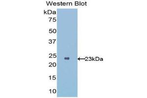 Western Blotting (WB) image for anti-Interleukin 1 Receptor-Like 1 (IL1RL1) (AA 162-349) antibody (ABIN1176679)