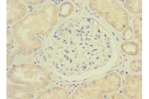 Immunohistochemistry of paraffin-embedded human kidney tissue using ABIN7175065 at dilution of 1:100 (C11orf1 Antikörper  (AA 33-150))