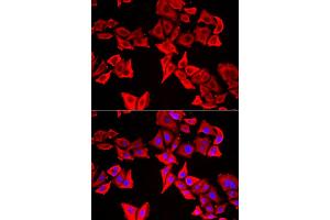 Immunofluorescence analysis of U20S cell using THRSP antibody. (THRSP Antikörper)
