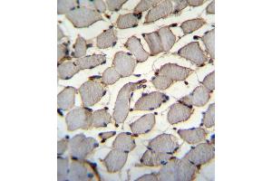 DDX60L Antibody (C-term) (ABIN655540 and ABIN2845051) immunohistochemistry analysis in formalin fixed and paraffin embedded human skeletal muscle followed by peroxidase conjugation of the secondary antibody and DAB staining. (DDX60L Antikörper  (C-Term))