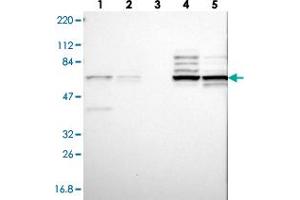 Western blot analysis of Lane 1: RT-4, Lane 2: U-251 MG, Lane 3: Human Plasma, Lane 4: Liver, Lane 5: Tonsil with CNOT4 polyclonal antibody . (CNOT4 Antikörper)