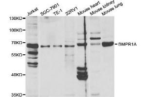 Western blot analysis of extracts of various cell lines, using BMPR1A antibody. (BMPR1A Antikörper  (AA 24-200))