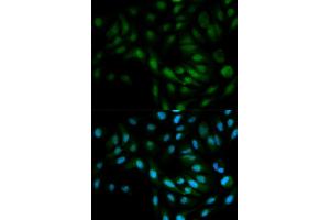Immunofluorescence analysis of MCF-7 cells using MAPK7 antibody.