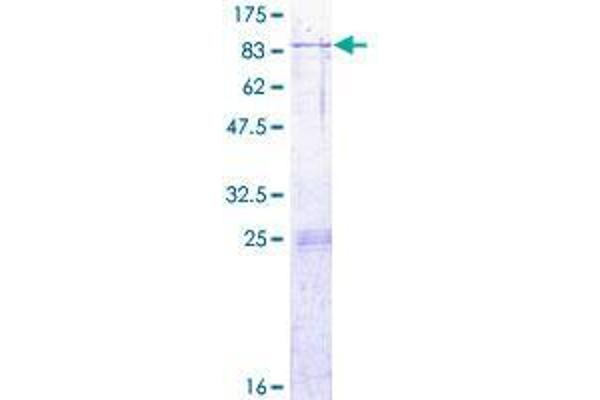 Arylsulfatase K Protein (ARSK) (AA 1-536) (GST tag)