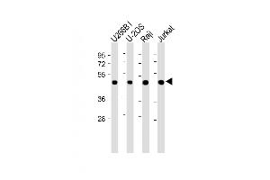 All lanes : Anti-ETV6 Antibody (N-term) at 1:2000 dilution Lane 1: U266B1 whole cell lysate Lane 2: U-2OS whole cell lysate Lane 3: Raji whole cell lysate Lane 4: Jurkat whole cell lysate Lysates/proteins at 20 μg per lane. (ETV6 Antikörper  (N-Term))