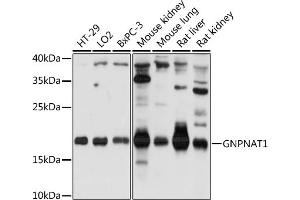 Western blot analysis of extracts of various cell lines, using GNPN antibody (ABIN7267399) at 1:1000 dilution. (GNPNAT1 Antikörper  (AA 1-91))
