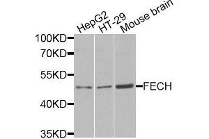 Western blot analysis of extracts of various cells, using FECH antibody. (FECH Antikörper)