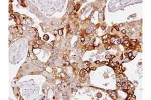 IHC-P Image Immunohistochemical analysis of paraffin-embedded H441 xenograft, using PDE4D, antibody at 1:100 dilution.