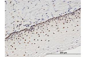 Immunoperoxidase of monoclonal antibody to STRADA on formalin-fixed paraffin-embedded human uterine cervix. (STRADA Antikörper  (AA 251-346))