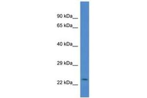 Image no. 1 for anti-Cysteine and Glycine-Rich Protein 2 (CSRP2) (AA 90-139) antibody (ABIN6746083) (CSRP2 Antikörper  (AA 90-139))