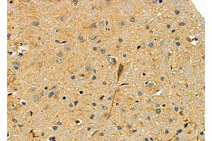 ABIN6265196 and ABIN6277869 at 1/100 staining Rat brain tissue by IHC-P. (SMURF2 Antikörper  (Internal Region))
