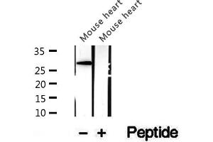 Western blot analysis of extracts of mouse heart tissue, using CHMP4B antibody. (CHMP4B Antikörper  (N-Term))