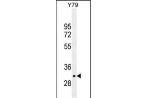 LRRC46 Antibody (N-term) (ABIN655306 and ABIN2844888) western blot analysis in Y79 cell line lysates (35 μg/lane). (LRRC46 Antikörper  (N-Term))