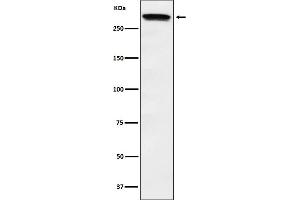 Western blot analysis of Huntingtin expression in HeLa cell lysate.