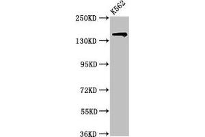 Western Blot Positive WB detected in: K562 whole cell lysate All lanes: SIN3A antibody at 2 μg/mL Secondary Goat polyclonal to rabbit IgG at 1/50000 dilution Predicted band size: 146 kDa Observed band size: 146 kDa (SIN3A Antikörper  (AA 1-123))