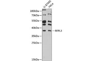 Western blot analysis of extracts of various cell lines, using RFPL3 antibody (ABIN6130677, ABIN6146893, ABIN6146894 and ABIN6215966) at 1:3000 dilution. (RFPL3 Antikörper  (AA 1-288))