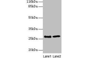 Western blot All lanes: EBP antibody at 2 μg/mL Lane 1: A549 whole cell lysate Lane 2: 293T whole cell lysate Secondary Goat polyclonal to rabbit IgG at 1/10000 dilution Predicted band size: 27 kDa Observed band size: 27 kDa (EBP Antikörper  (AA 2-230))