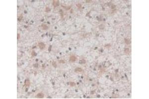 Immunohistochemistry (IHC) image for anti-Transmembrane Protein 27 (TMEM27) (AA 17-137) antibody (ABIN7427249)