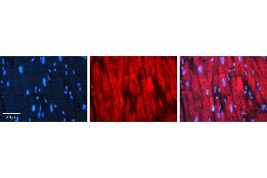 Rabbit Anti-CDC34 Antibody  AV Formalin Fixed Paraffin Embedded Tissue: Human heart Tissue Observed Staining: Cytoplasmic near intercalated discs Primary Antibody Concentration: 1:100 Other Working Concentrations: N/A Secondary Antibody: Donkey anti-Rabbit-Cy3 Secondary Antibody Concentration: 1:200 Magnification: 20X Exposure Time: 0. (CDC34 Antikörper  (Middle Region))