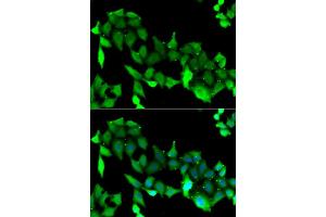 Immunofluorescence analysis of A549 cell using GRK6 antibody. (GRK6 Antikörper)