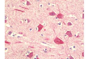 Anti-PPHLN1 antibody IHC staining of human brain, cortex. (PPHLN1 Antikörper  (Internal Region))