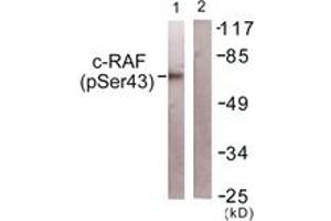 Western blot analysis of extracts from NIH-3T3 cells, using C-RAF (Phospho-Ser43) Antibody. (RAF1 Antikörper  (pSer43))